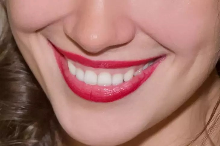 Sonrisa, dientes