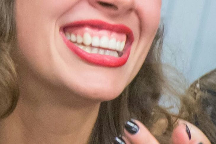 dientes, sonrisa