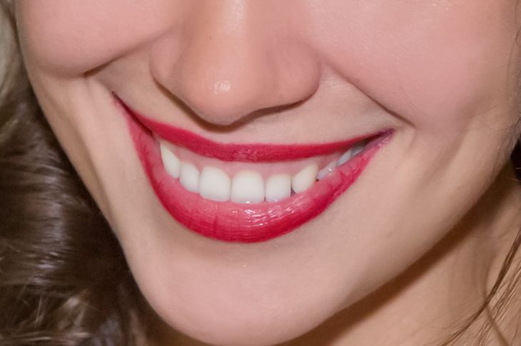 Sourire, dents