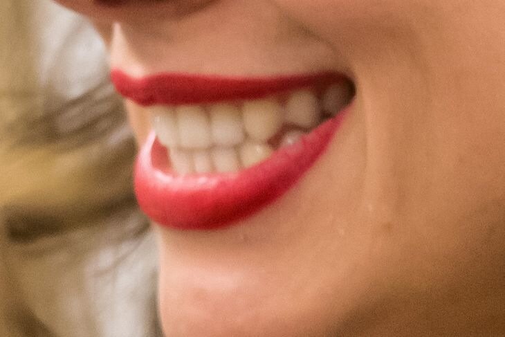 Dientes