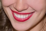 Sourire, dents